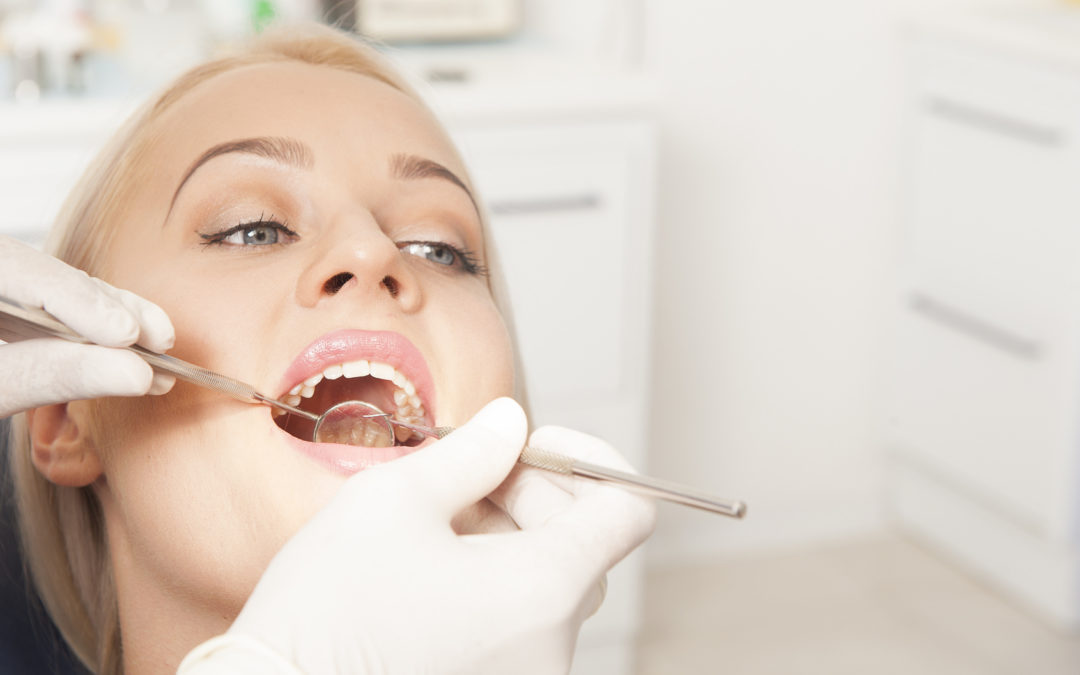 When Should You Replace Metal with Composite Fillings?