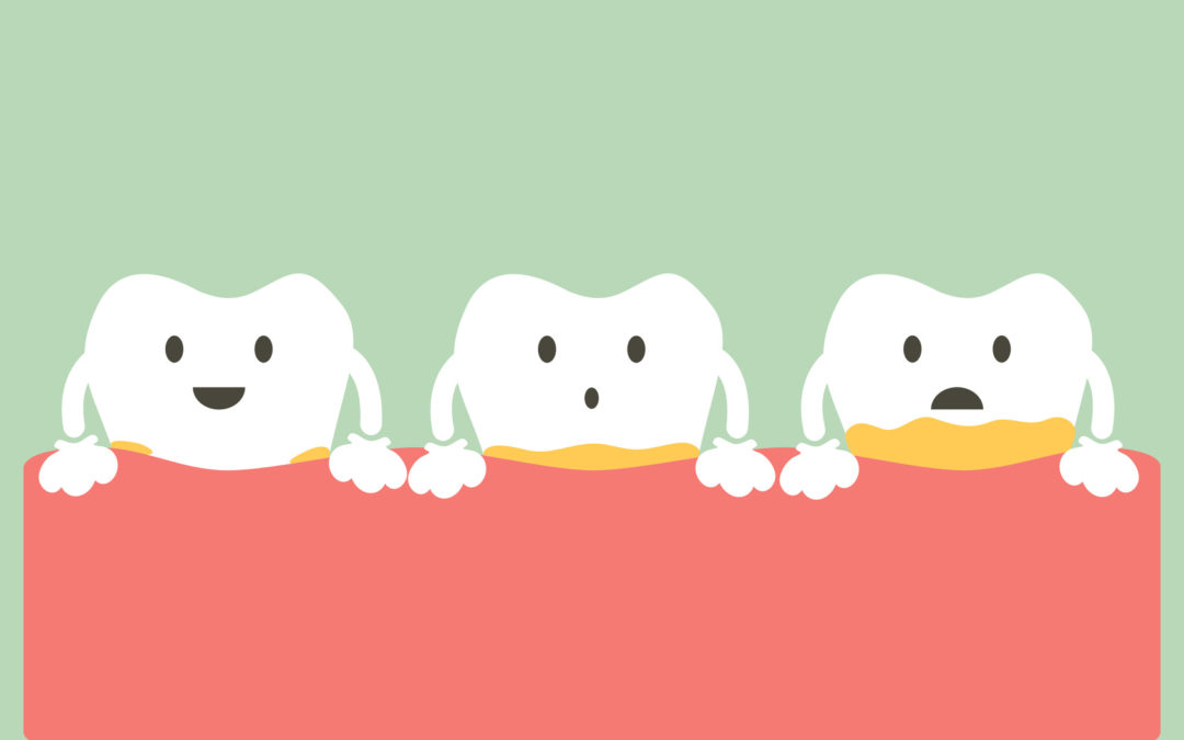 What You Should Know About Periodontal Disease Stages