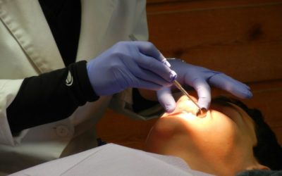 4 Surprising Reasons People May Need Cosmetic Dentistry