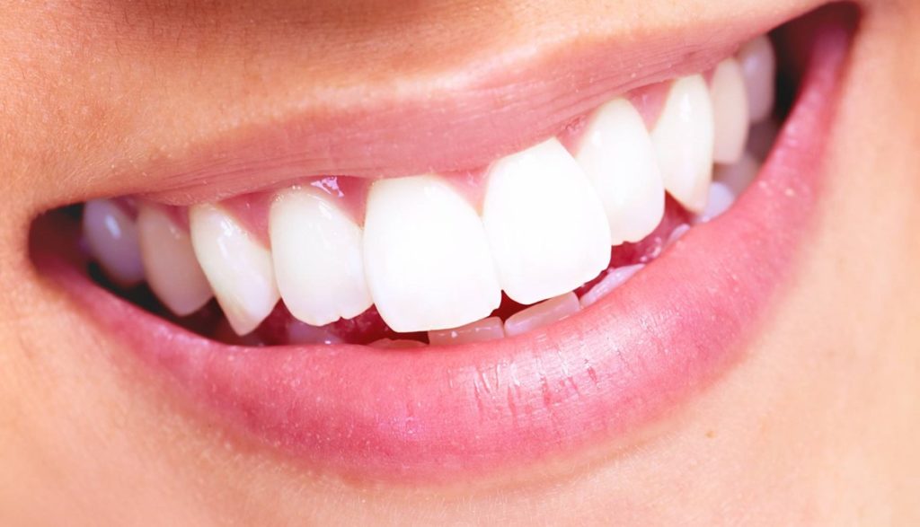 the dangers of diy teeth whitening