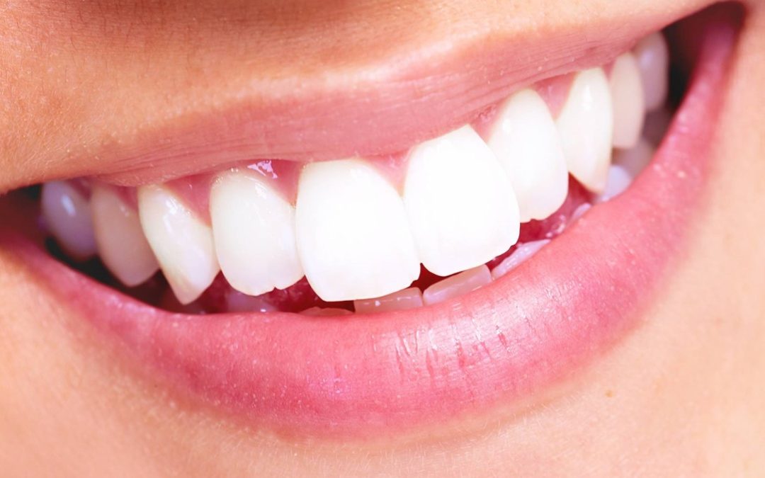 the dangers of diy teeth whitening