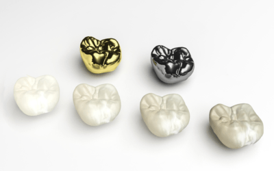All You Need to Know About Dental Crowns