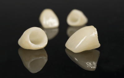 The Advantages and Disadvantages of Dental Crowns